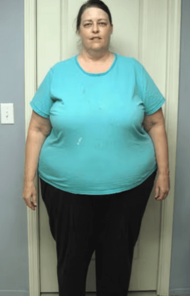 Avant, Morosil+ perte de poids